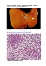 Prezentācija 'Kļūdu labojums patoloģijā', 21.