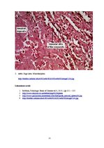 Prezentācija 'Kļūdu labojums patoloģijā', 25.