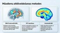 Prezentācija 'Neiropeptīds Y un galvenie neiromediatori', 20.