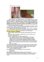 Konspekts 'Konspekts ķirurģijā studiju programmas 
“PODOLOĢIJA” eksāmenam', 6.