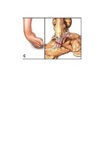 Referāts 'Sāpes pēdas locītavā', 7.
