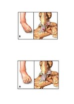 Referāts 'Sāpes pēdas locītavā', 8.