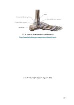 Referāts 'Sāpes pēdas locītavā', 27.