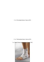 Referāts 'Sāpes pēdas locītavā', 28.