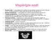 Prezentācija 'Soda veidi', 2.