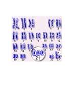 Referāts 'Latvijas sabiedrības attieksme pret garīgi slimiem bērniem. Dauna sindroms', 24.