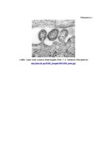 Referāts 'Vīrusu hemorāģiskie drudži Latvijā', 13.