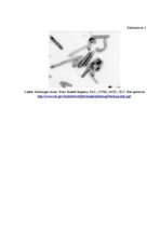 Referāts 'Vīrusu hemorāģiskie drudži Latvijā', 14.