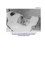 Referāts 'Vīrusu hemorāģiskie drudži Latvijā', 15.