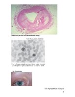 Referāts 'Hiperlipidēmija un aptaukošanās', 19.