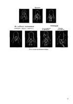 Referāts 'Gaisa kuģu cilvēku evakuācijas sistēma', 31.