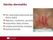 Prezentācija 'Lokālas infekcijas neonatālā periodā', 3.