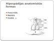 Prezentācija 'Hipospādija un epispādija', 5.