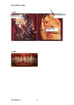 Referāts 'Kāpēc smēķēšana ir kaitīga?', 8.