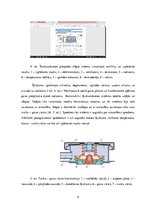 Konspekts 'Dzesēšanas sistēmu veidi un uzbūve', 5.