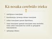 Prezentācija 'Cerebrālā trieka', 4.