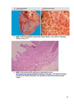 Referāts 'Kolokvija kļūdu labojums', 19.