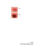 Referāts 'Internās aprūpes māsu zināšanas par izgulējumu profilaksi sociālās aprūpes centr', 36.