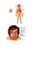 Konspekts 'Hantera sindroms', 8.