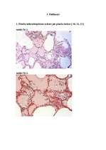 Referāts 'Plaušu tūska', 11.