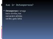 Prezentācija 'Osteoporoze', 2.