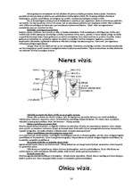 Konspekts 'Vēžu veidi', 14.