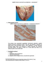 Konspekts 'Miokarda intracelulārā tauku deģenerācija', 4.