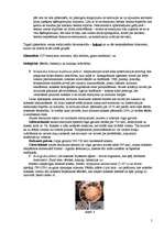 Referāts 'Centriski un ekscentriski spiestu kolonnu (statņu) pastiprināšana', 5.