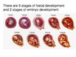 Prezentācija 'Foetal Development', 3.