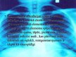 Prezentācija 'Kvantu fizikas pielietojums medicīnā', 9.