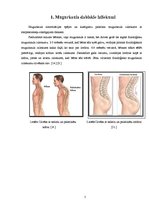 Referāts 'Skolioze', 5.