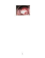 Konspekts 'Ginekoloģiskās infekcijas saslimšanas', 6.