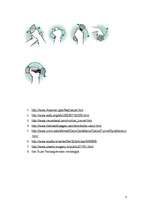 Konspekts 'Karpālā kanāla sindroms', 8.