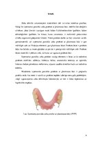 Referāts 'Bāzu plastmasas, to veidi un pielietojums izņemamo parciālo zobu protēžu ar plas', 4.