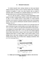 Referāts 'Supresijas dziļuma mērījumi cilvēkiem ar anizometropiju', 14.