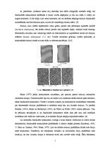 Referāts 'Supresijas dziļuma mērījumi cilvēkiem ar anizometropiju', 15.